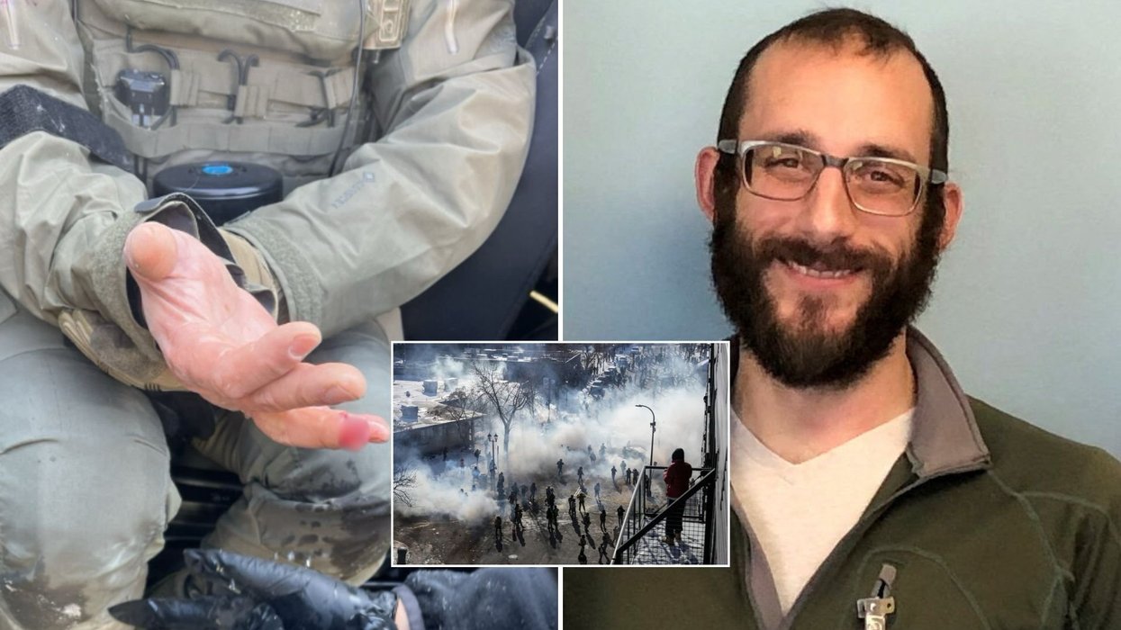 Minneapolis rioters 'bite off' officer's finger as protests erupt after fatal shooting of nurse