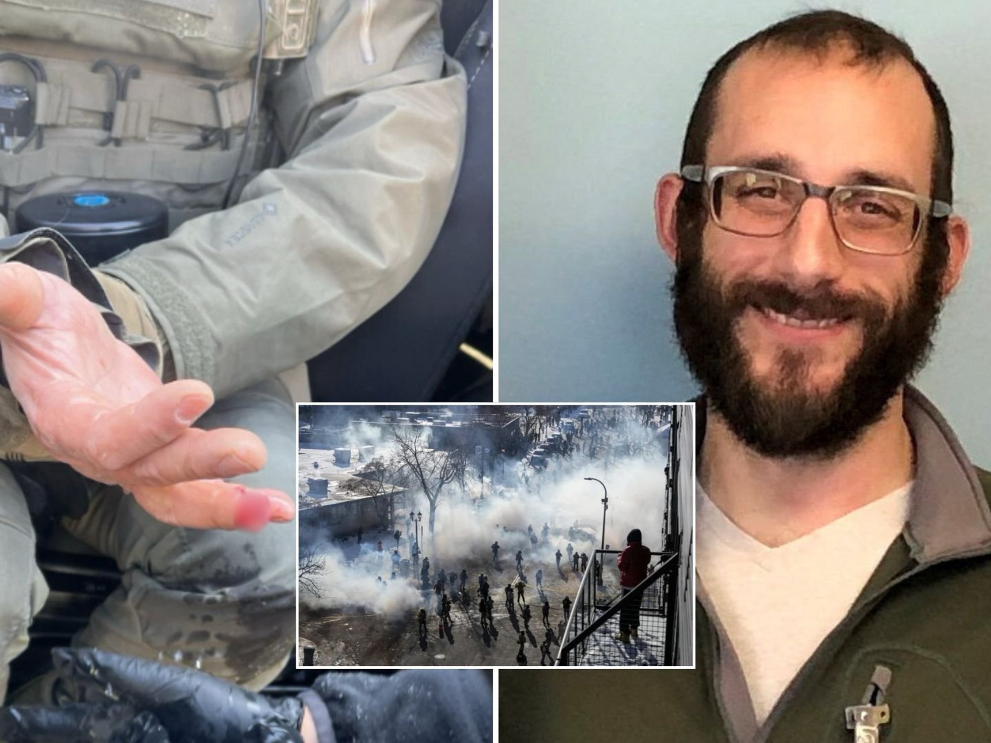 Minneapolis rioters 'bite off' officer's finger as protests erupt after fatal shooting of nurse