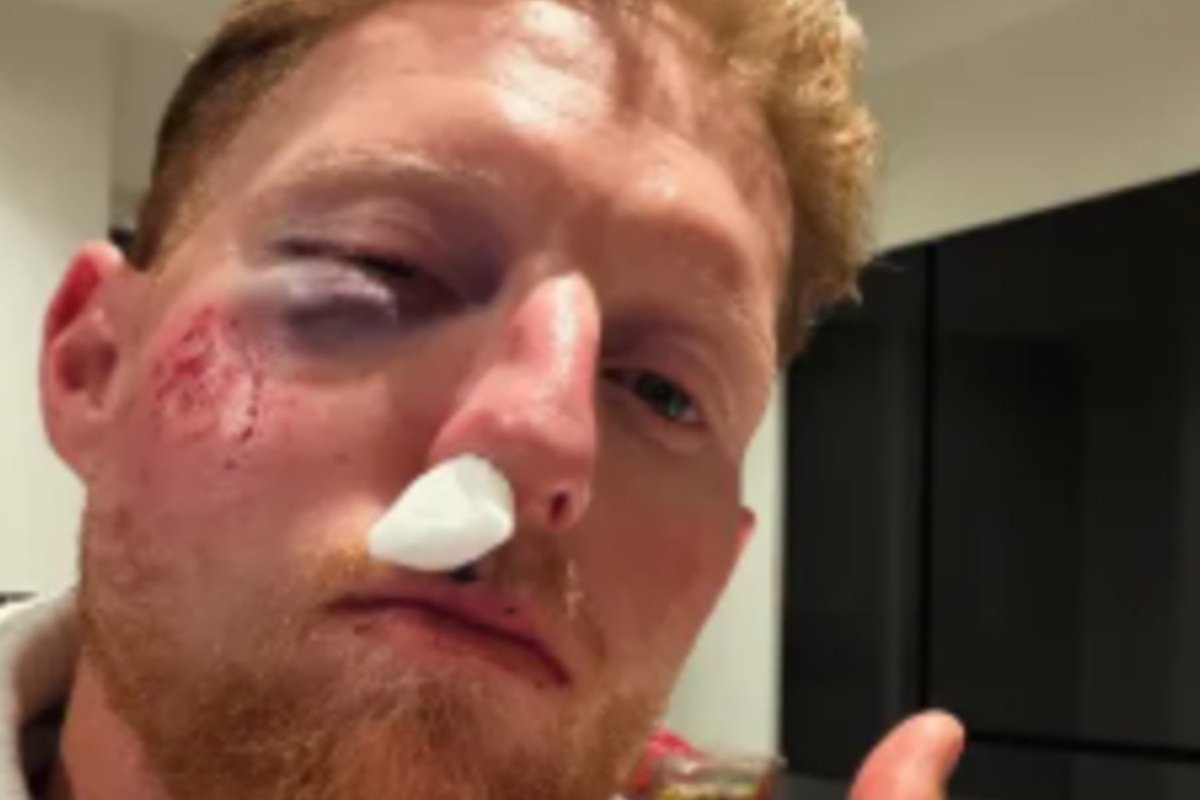Ben Stokes' classy phone call revealed after England star 'broke rule' and suffered nasty facial injuries