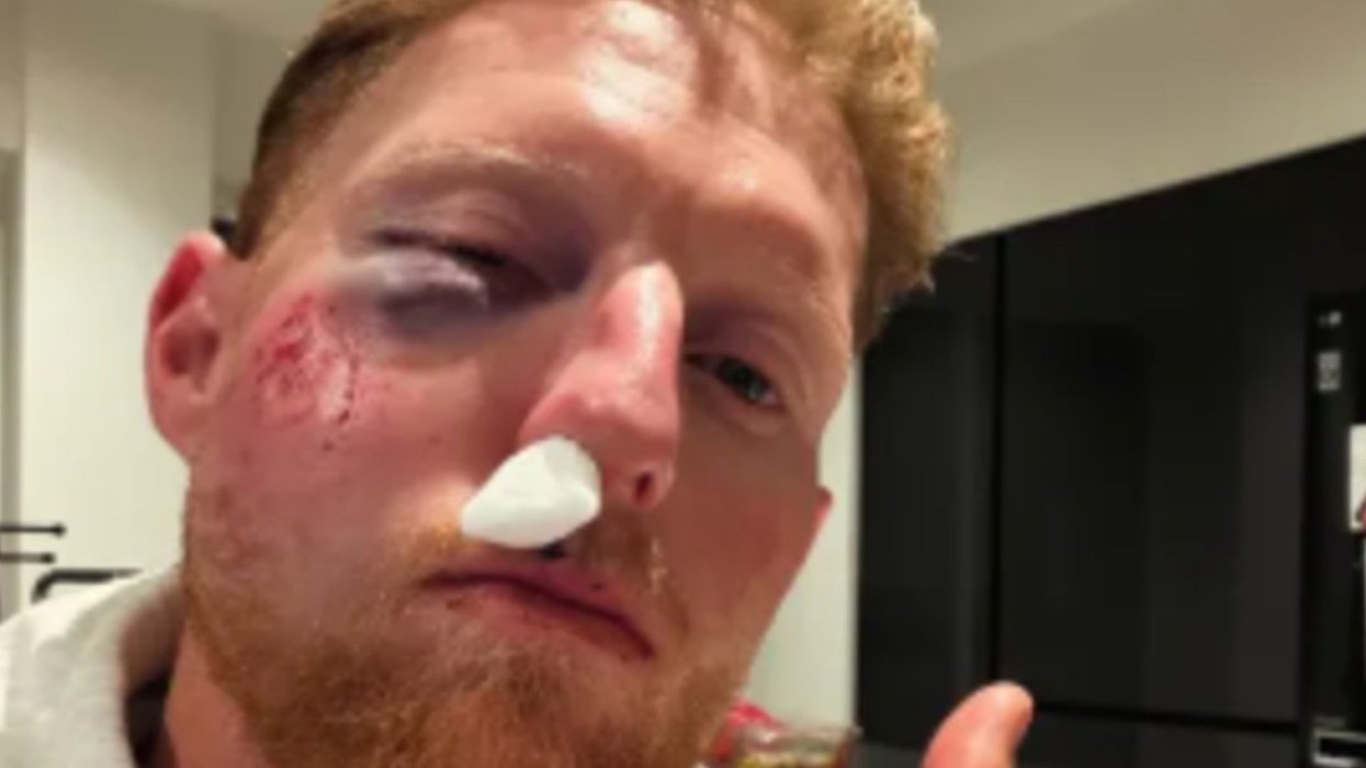 Ben Stokes' classy phone call revealed after England star 'broke rule' and suffered nasty facial injuries