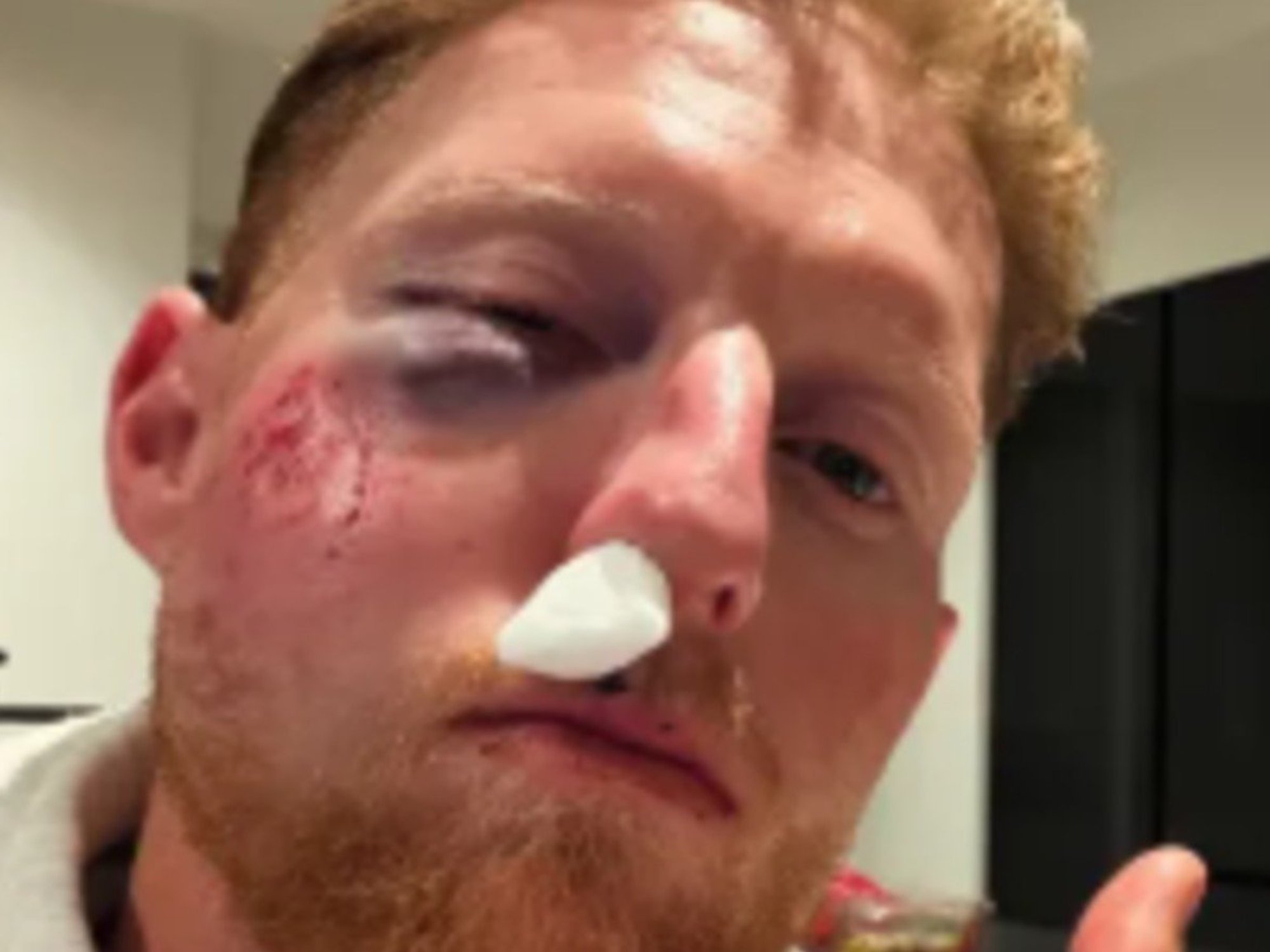 Ben Stokes' classy phone call revealed after England star 'broke rule' and suffered nasty facial injuries