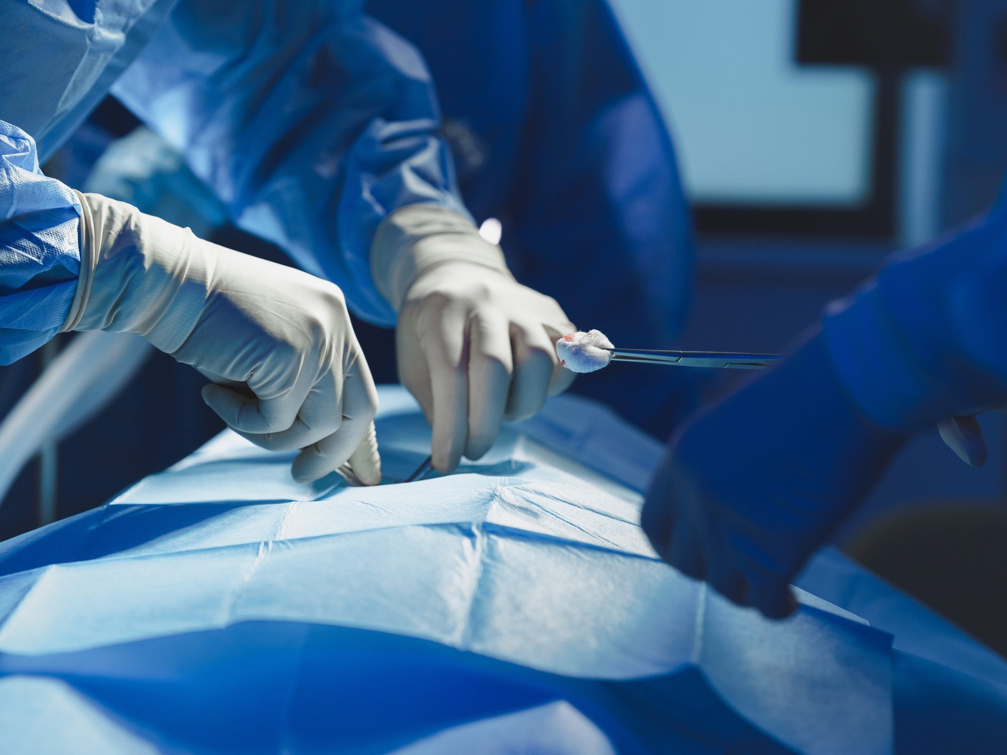 NHS cancels thousands of surgeries to save money with up to 140,000 patients set to be affected