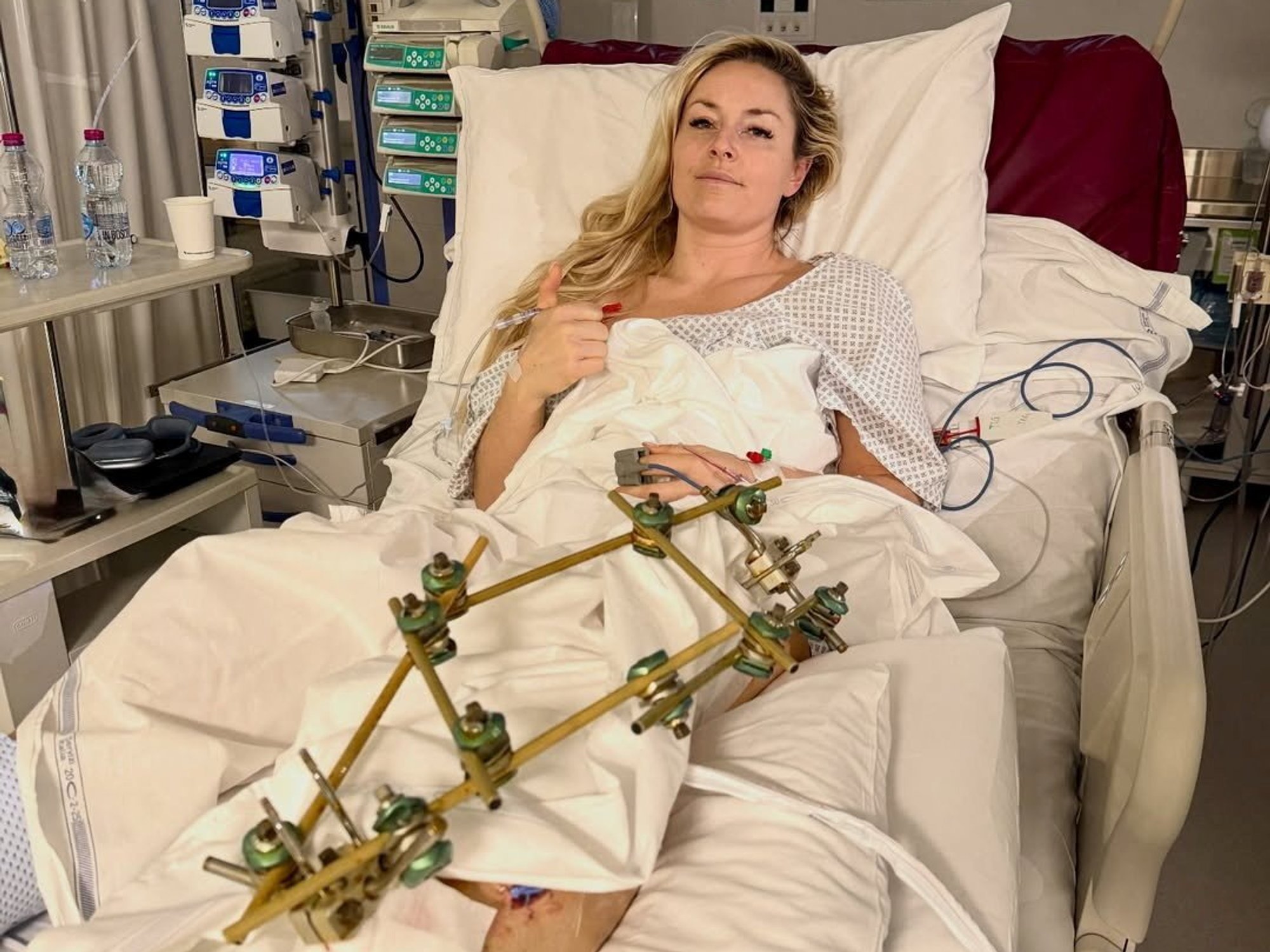 Lindsey Vonn's sister explains 'rough' week for Winter Olympics star in hospital after awful skiing crash