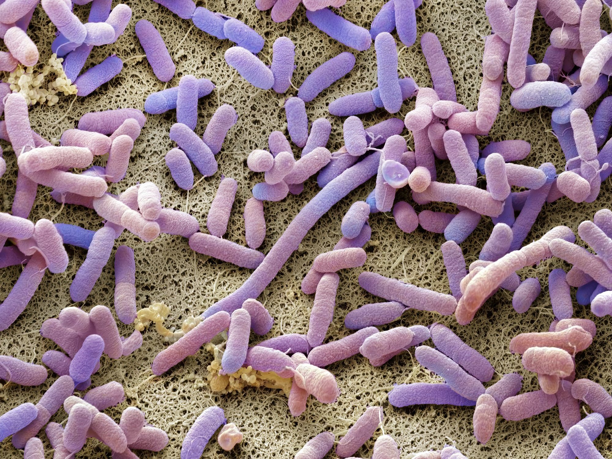 Mutant super-bug resistant to multiple modern antibiotics discovered trapped in 5,000-year-old ice