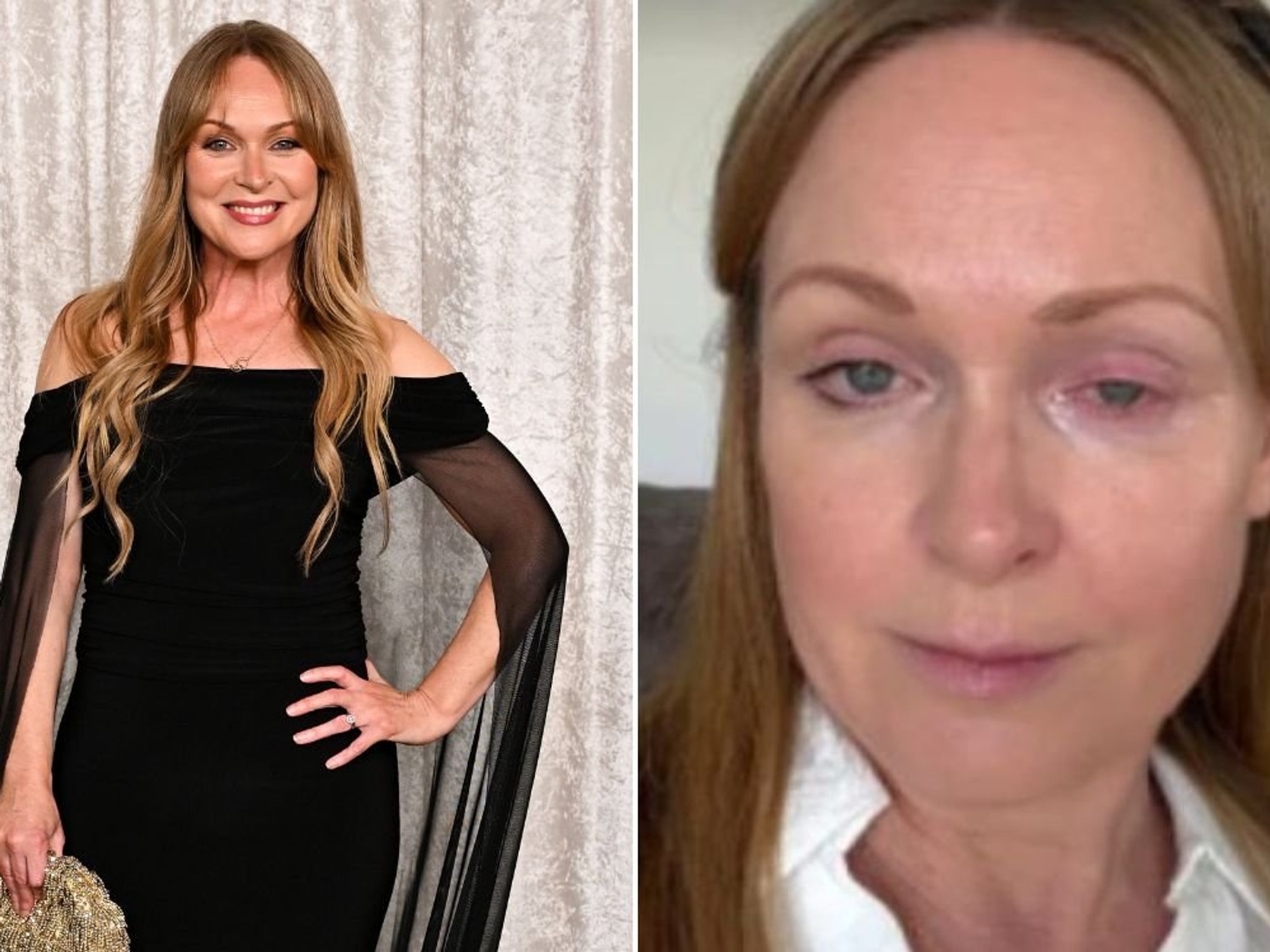 ITV Emmerdale star rushed to A&E as actress shares candid social media photo