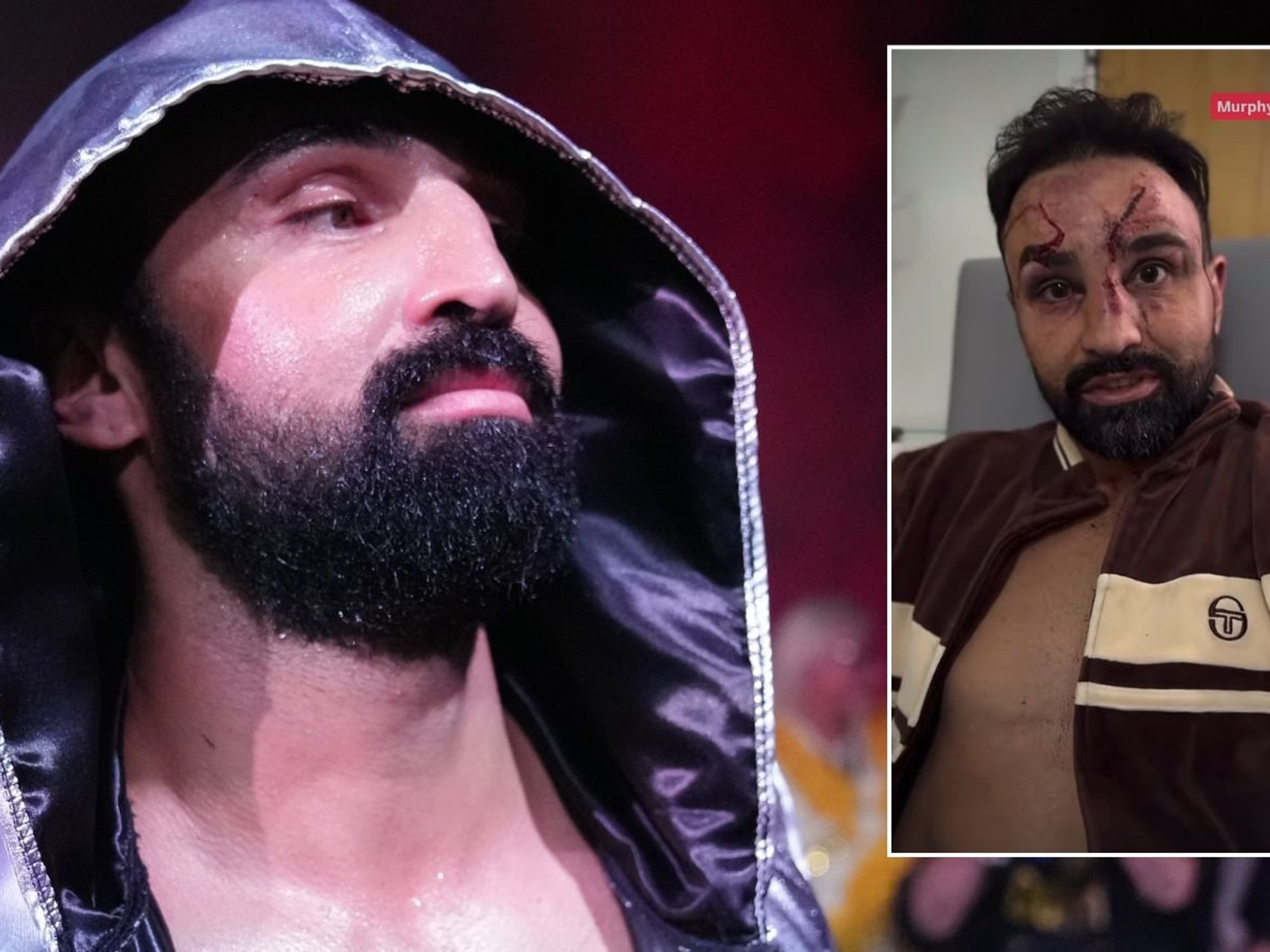 Boxing star blasts NHS staff with 'farm animals' jibe after horror hospital ordeal