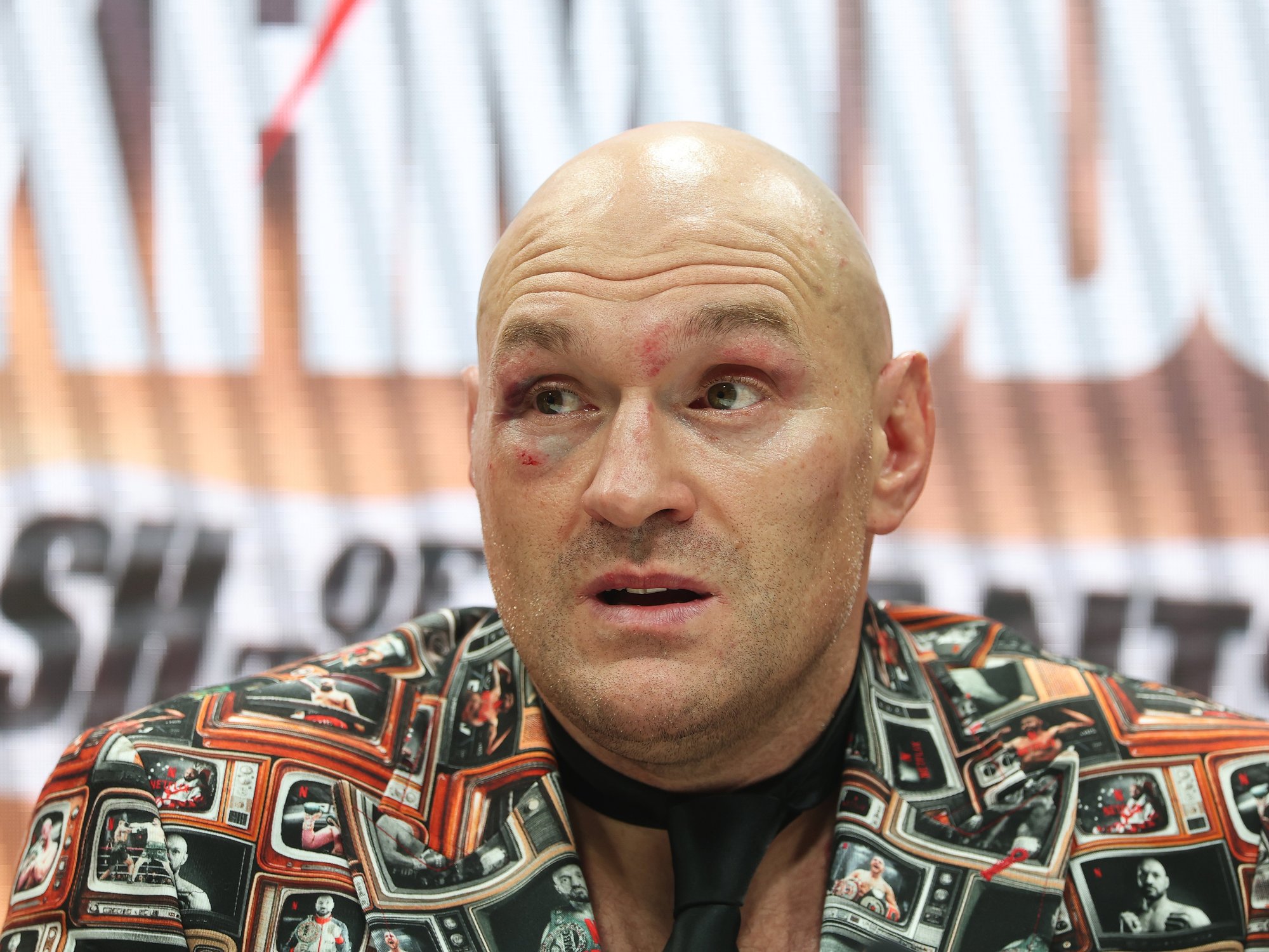 Frank Warren drops huge Tyson Fury next fight update ahead of Anthony Joshua bout