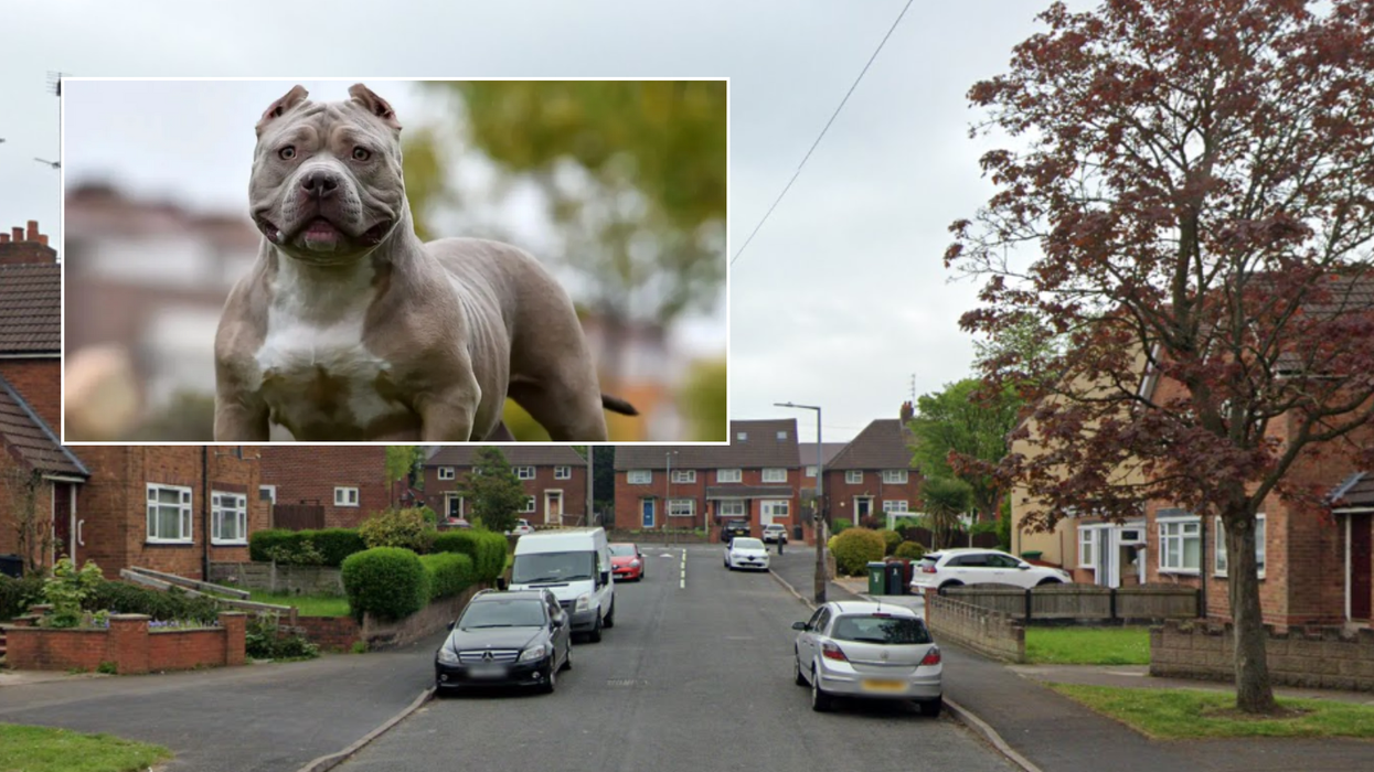 'XL Bully' dog attack leaves man fighting for his life after vicious assault in back garden