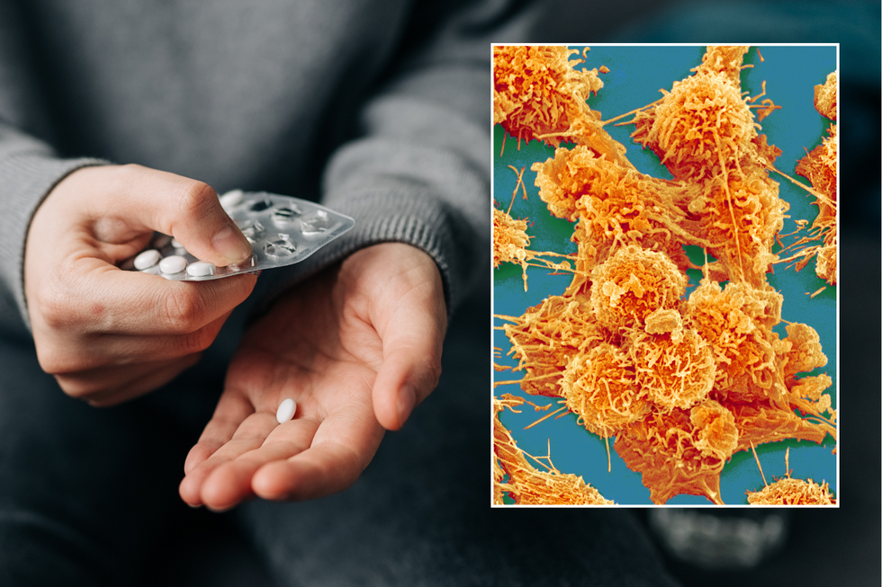 Over-the-counter pill could halve risk of colon cancer, British study reveals