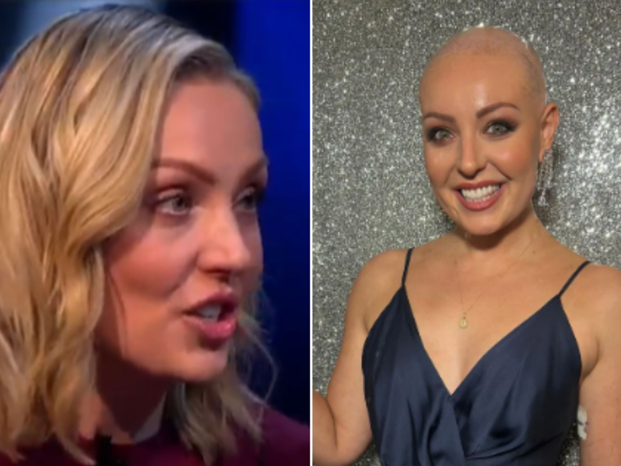 BBC Strictly’s Amy Dowden shares heartbreaking cancer update after second mastectomy: ‘I’m no lon...
