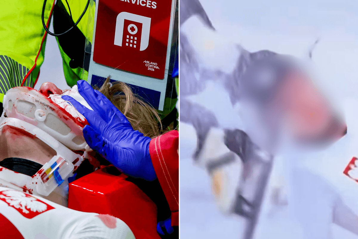Winter Olympics star has face slashed open in horror speed skating accident
