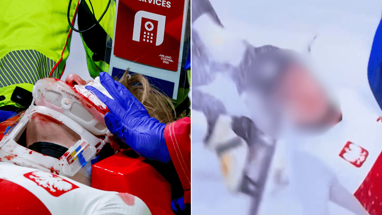 Winter Olympics star has face slashed open in horror speed skating accident