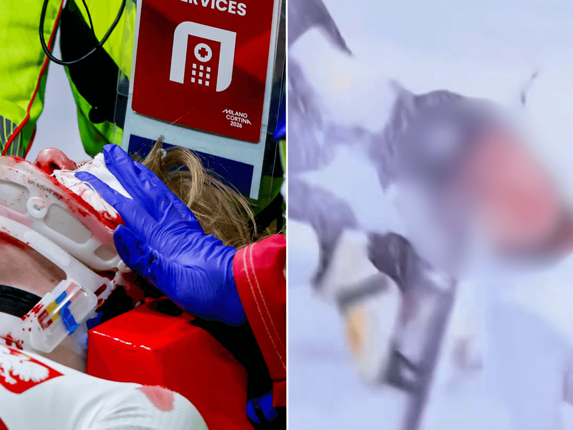 Winter Olympics star has face slashed open in horror speed skating accident