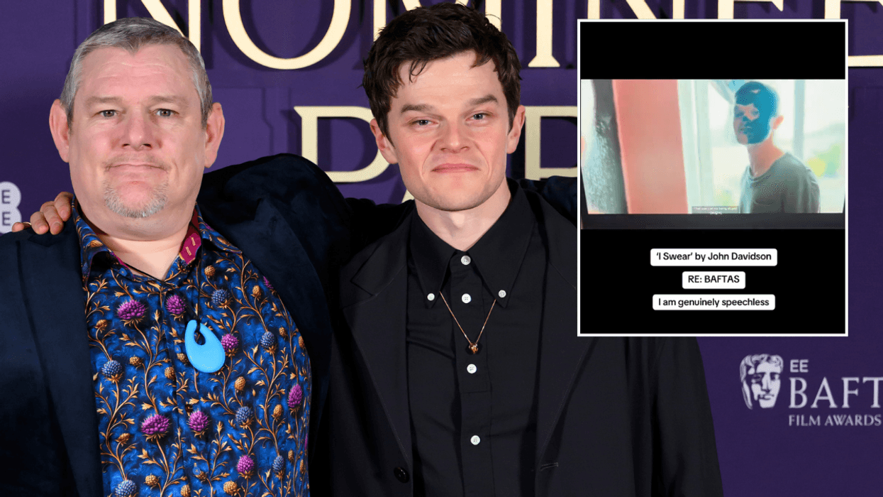 I Swear now embroiled in bizarre racism row as critics accuse John Davidson biopic of 'blackface' amid Baftas saga