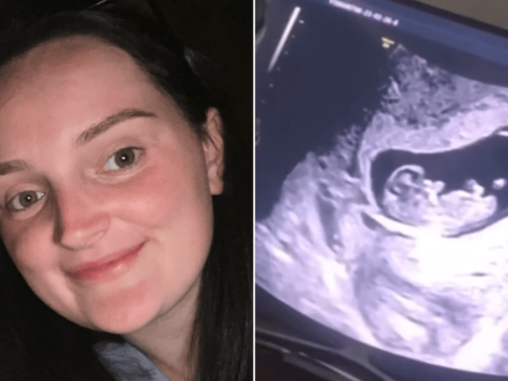 Mille Radford shares update on baby number four as 22 Kids and Counting star teases major detail