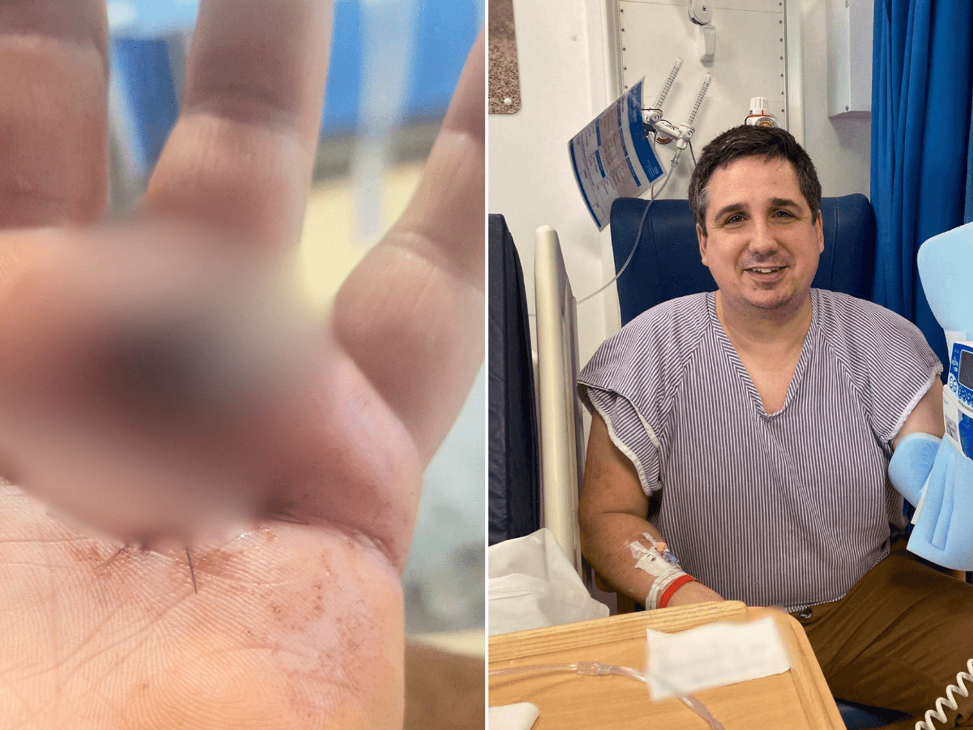 Briton hospitalised after being POISONED while out picking berries in bid to brew homemade gin