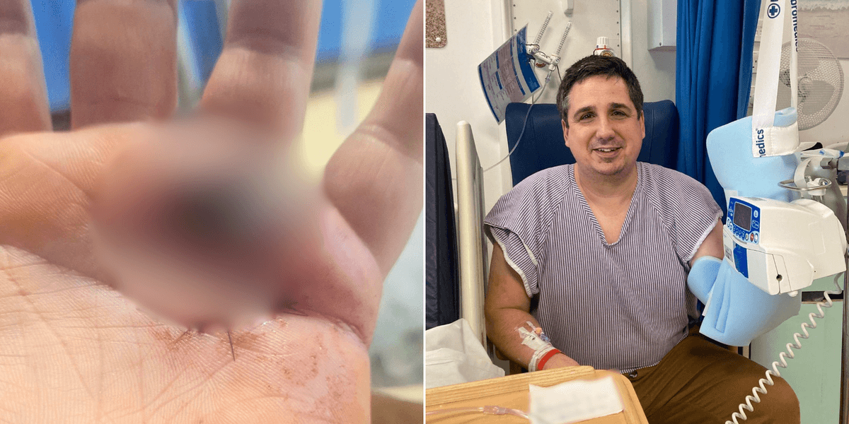 Man hospitalised after being POISONED while out picking berries in bid to brew homemade gin Man hospitalised after being POISONED while out picking berries in bid to brew homemade gin