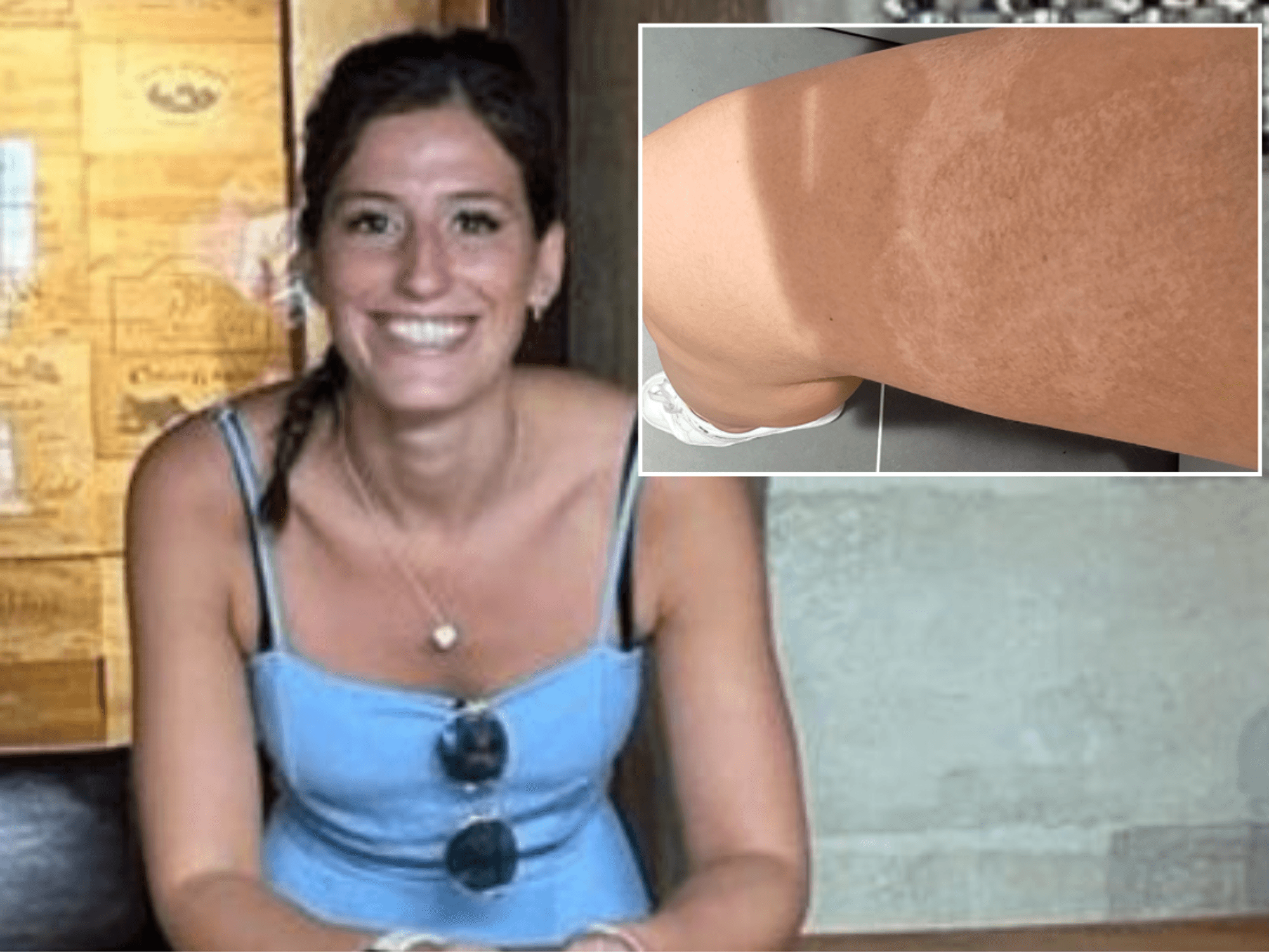 Ryanair passenger gets £4,000 payout after boiling tea poured over her lap in 'horrible experience'