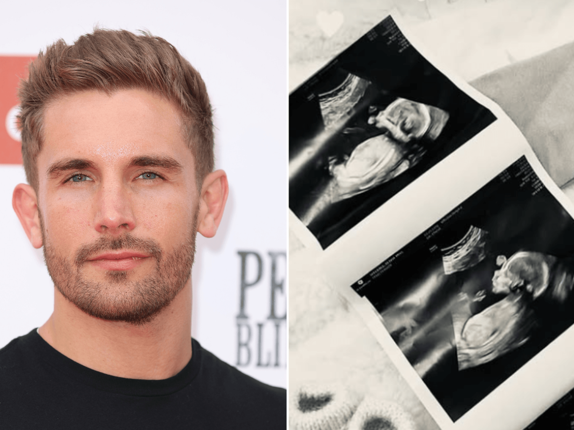 Adam Woodward sparks frenzy with surprise family announcement as Hollyoaks co-stars react