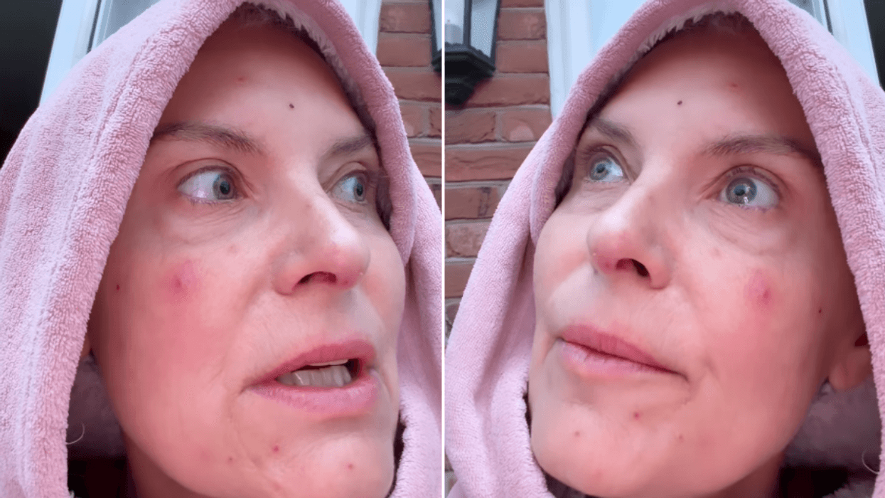 ITV Coronation Street star Tracy Shaw rushed from critical care as doctors investigate mystery infection