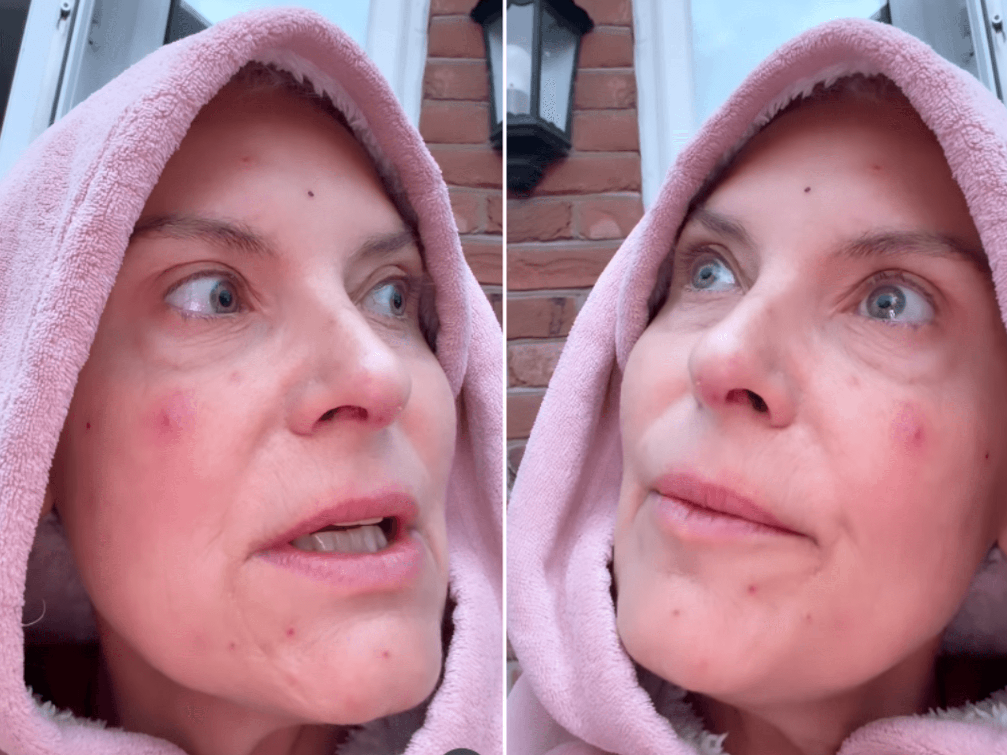 ITV Coronation Street star Tracy Shaw rushed from critical care as doctors investigate mystery infection
