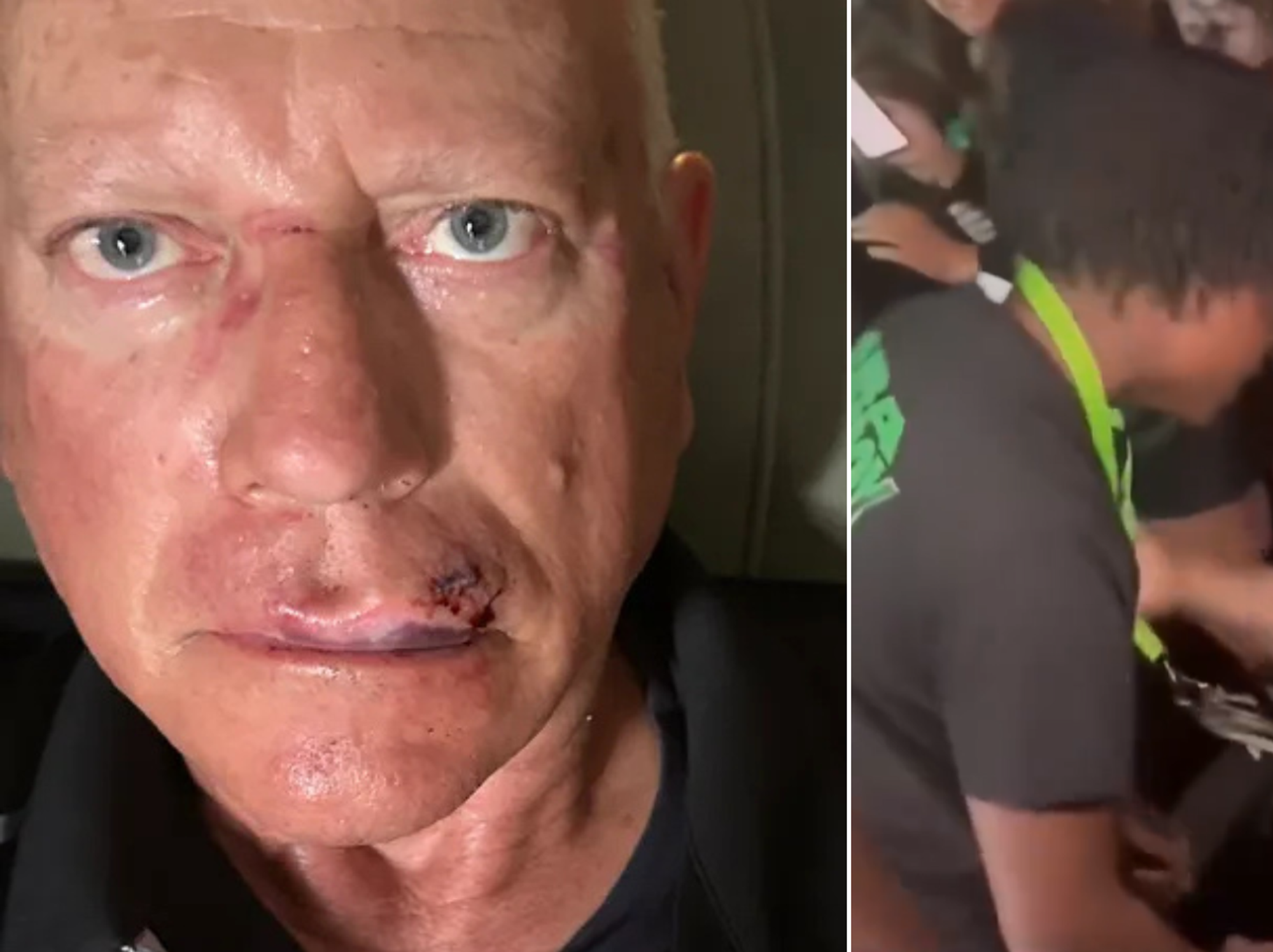 Images of the incident and the resulting injuries