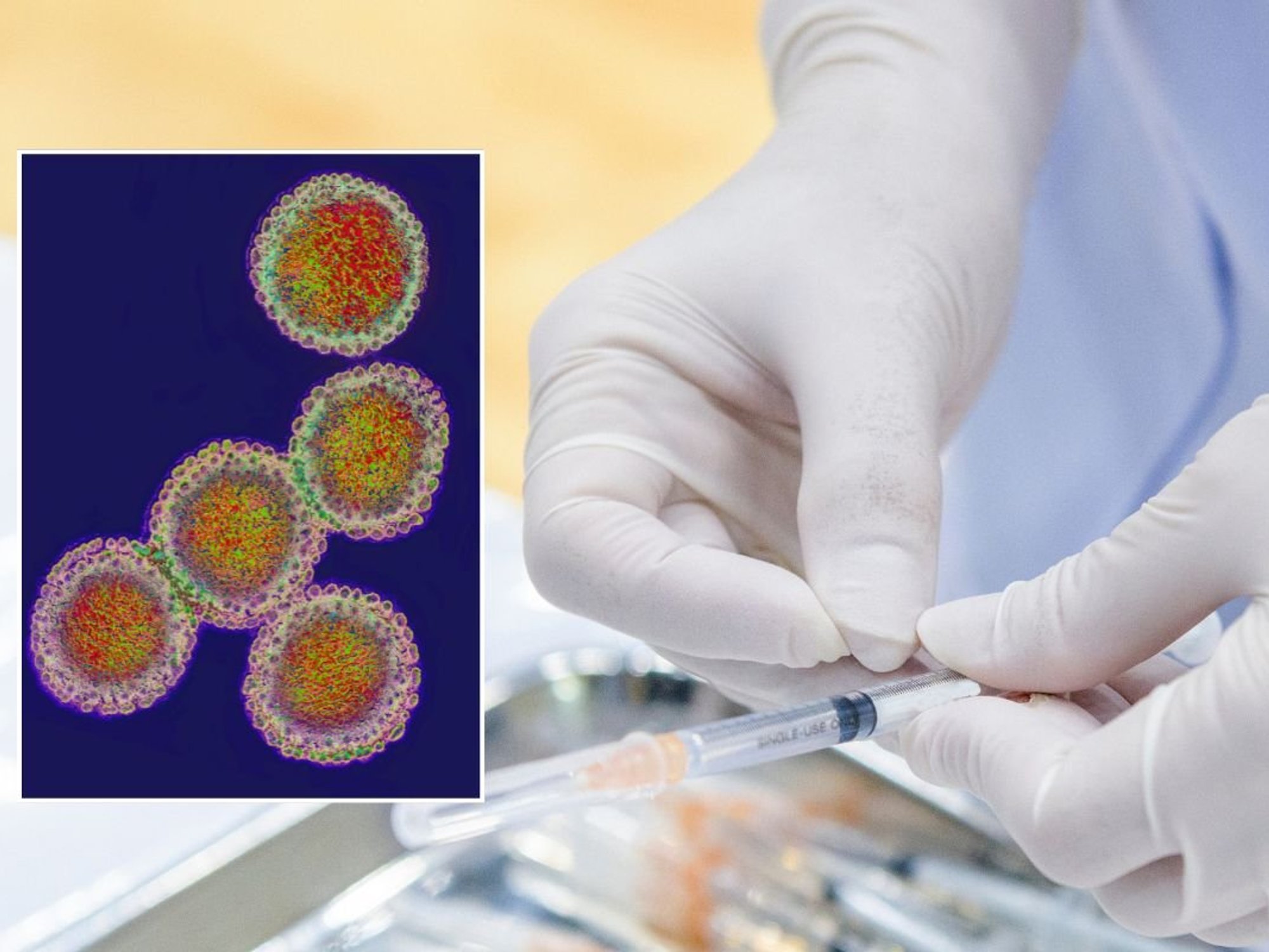 influenza strain under microscope and vaccine preparation