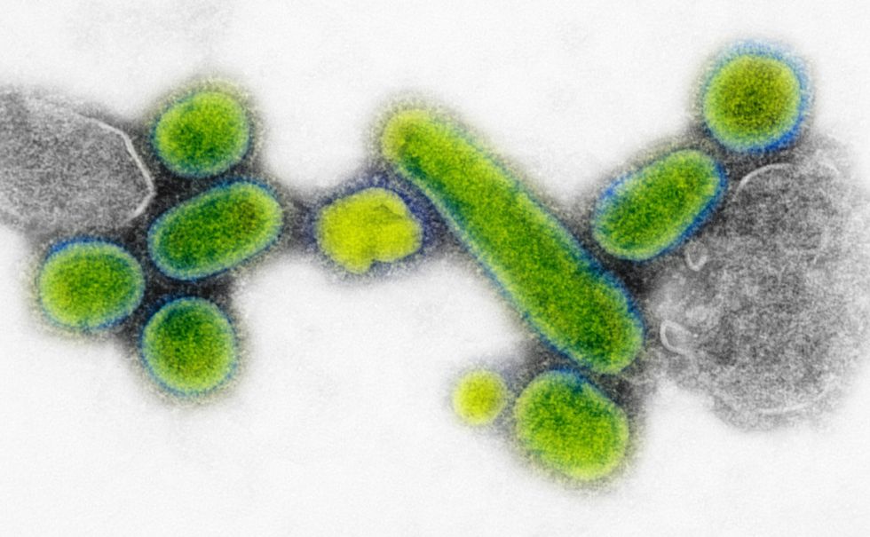 INFLUENZA VIRUS