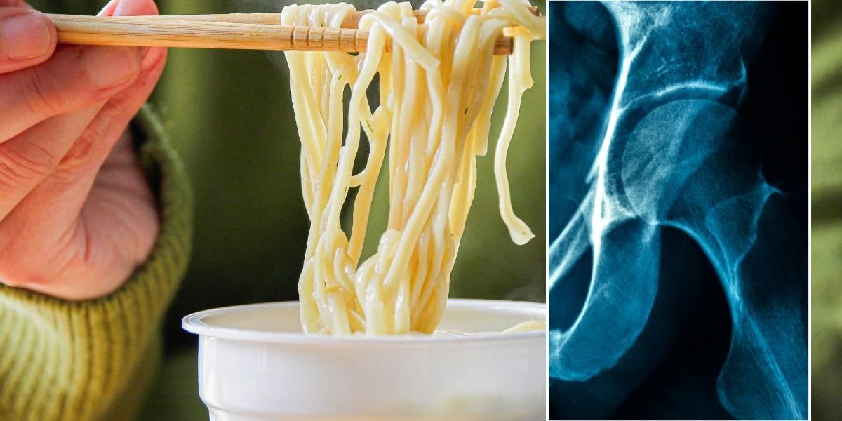 Osteoporosis risk linked to midlife diet error that many women overlook Osteoporosis risk linked to midlife diet error that many women overlook