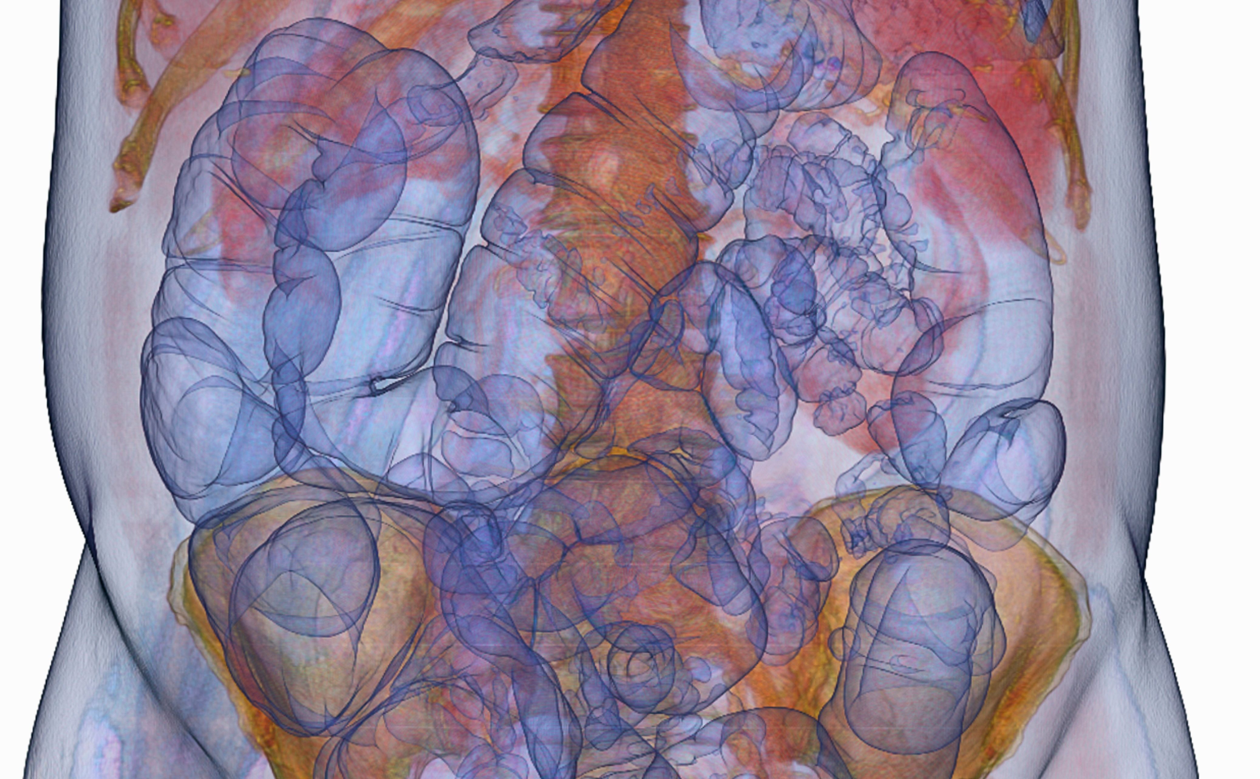 intestines