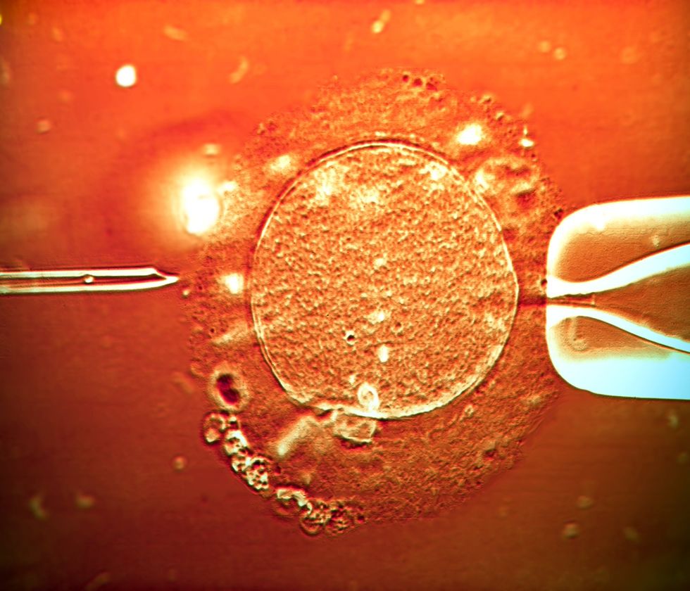 IVF IN CLINIC