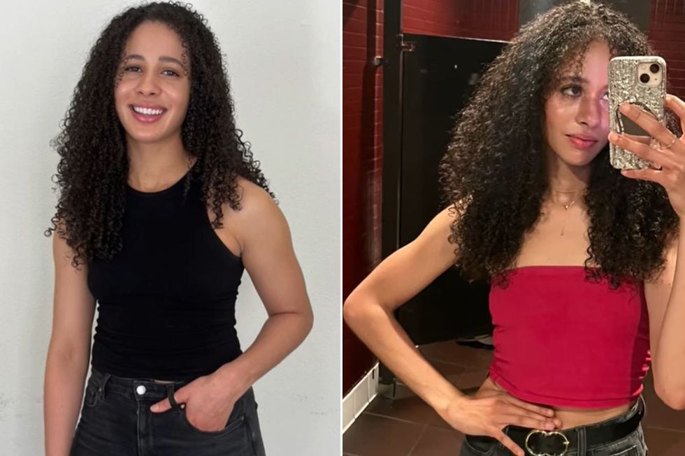 Jasmine before and after arms