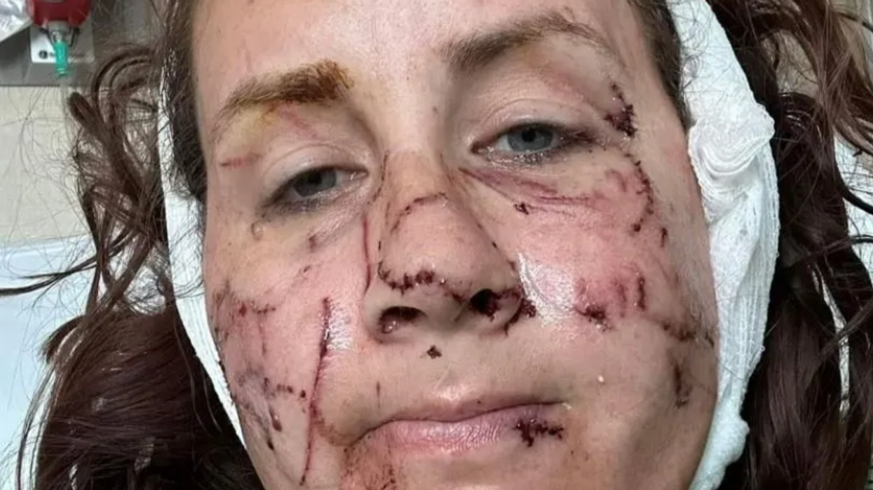Jen Royce's injuries