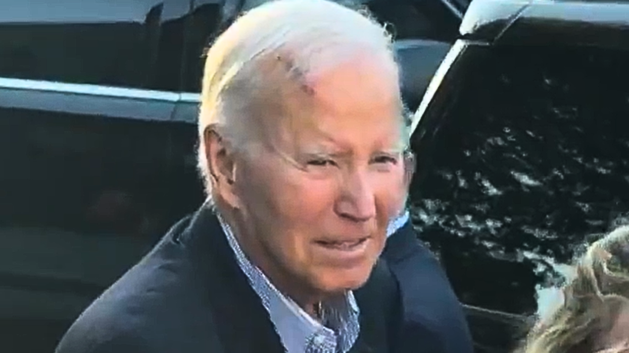 Joe Biden wound