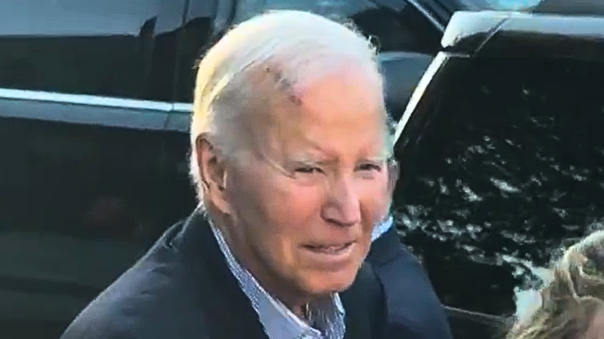 Joe Biden wound