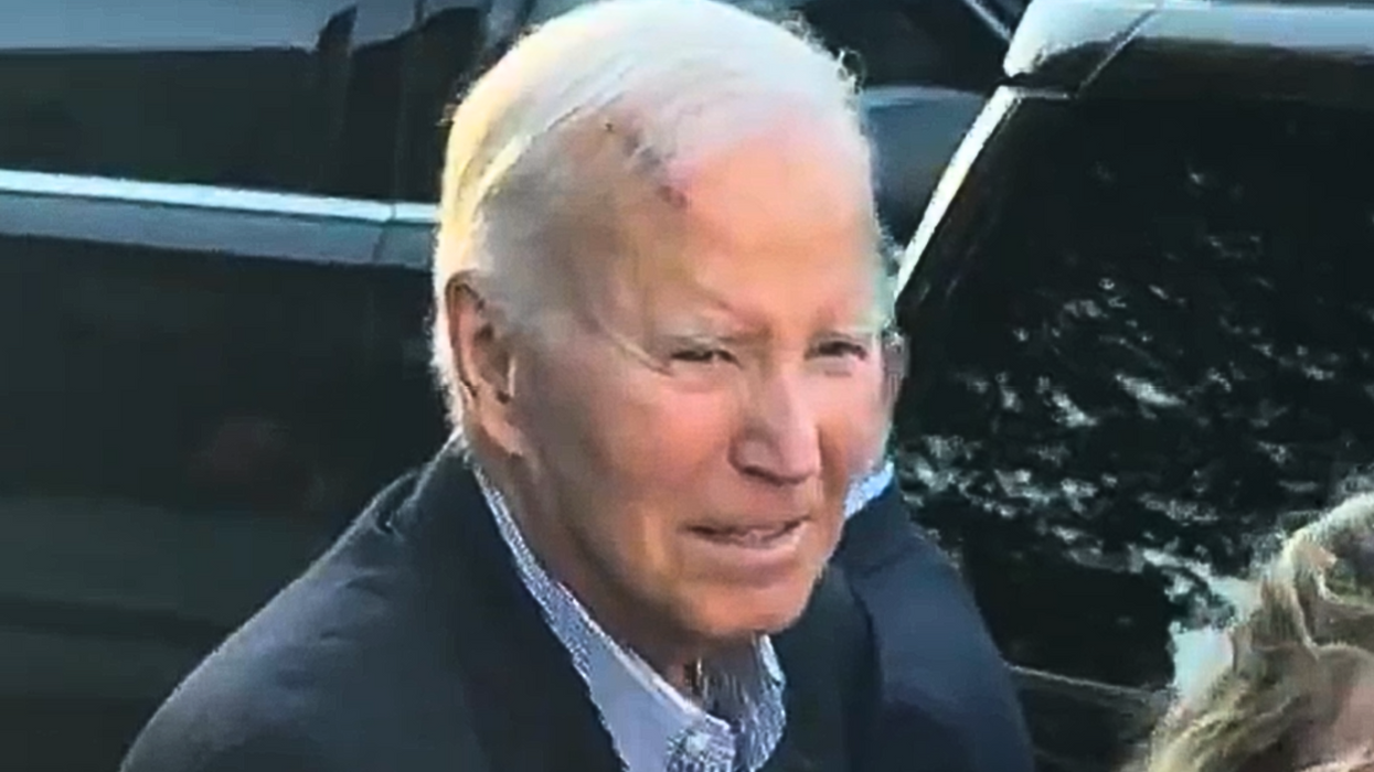 Joe Biden wound