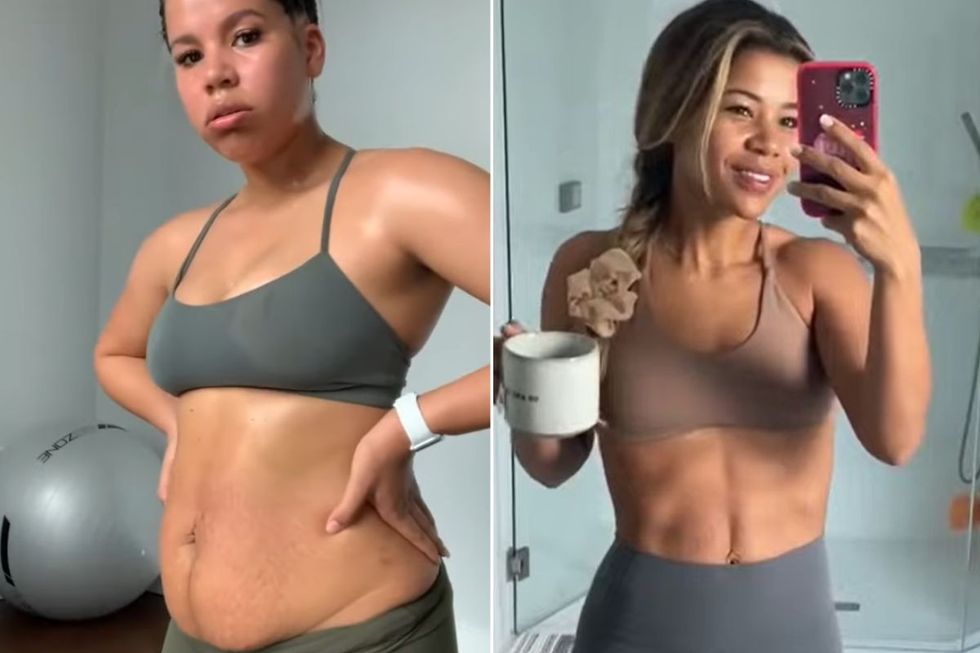 Johanna Sophia BEFORE AND AFTER