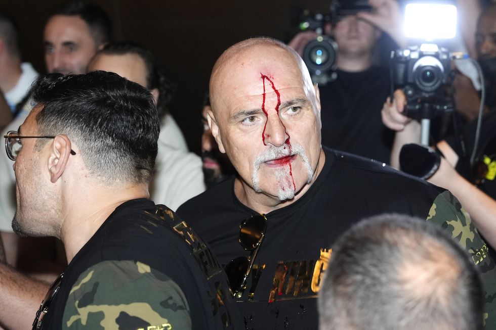 John Fury was left bleeding from his forehead