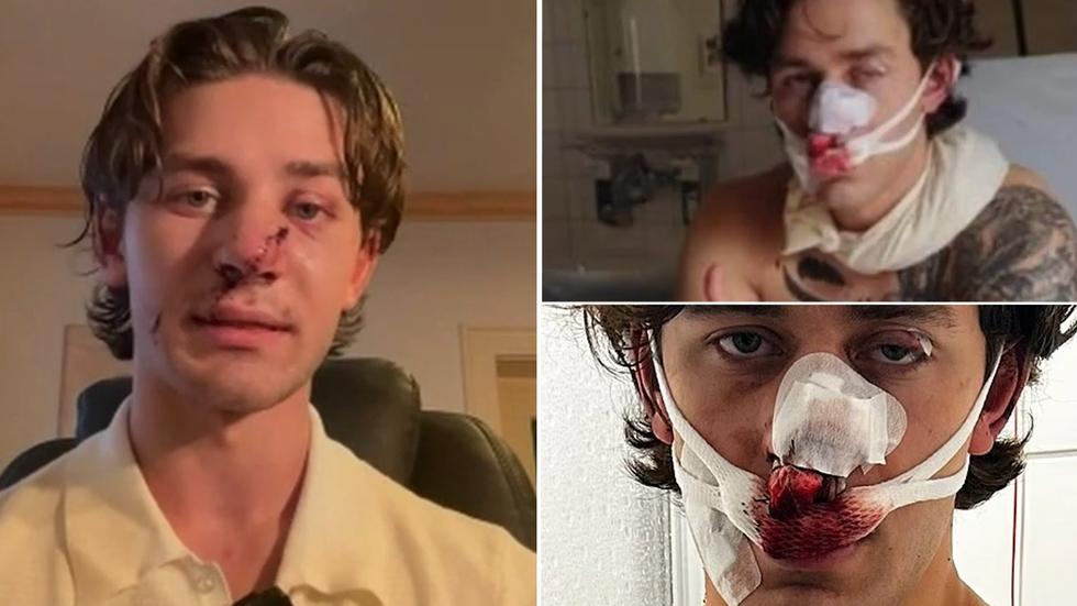 John Rudat speaking on GB News with inset images showing his gruesome facial injuries