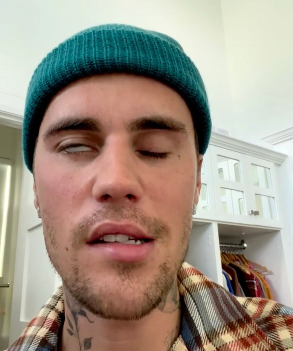 Justin Bieber's condition