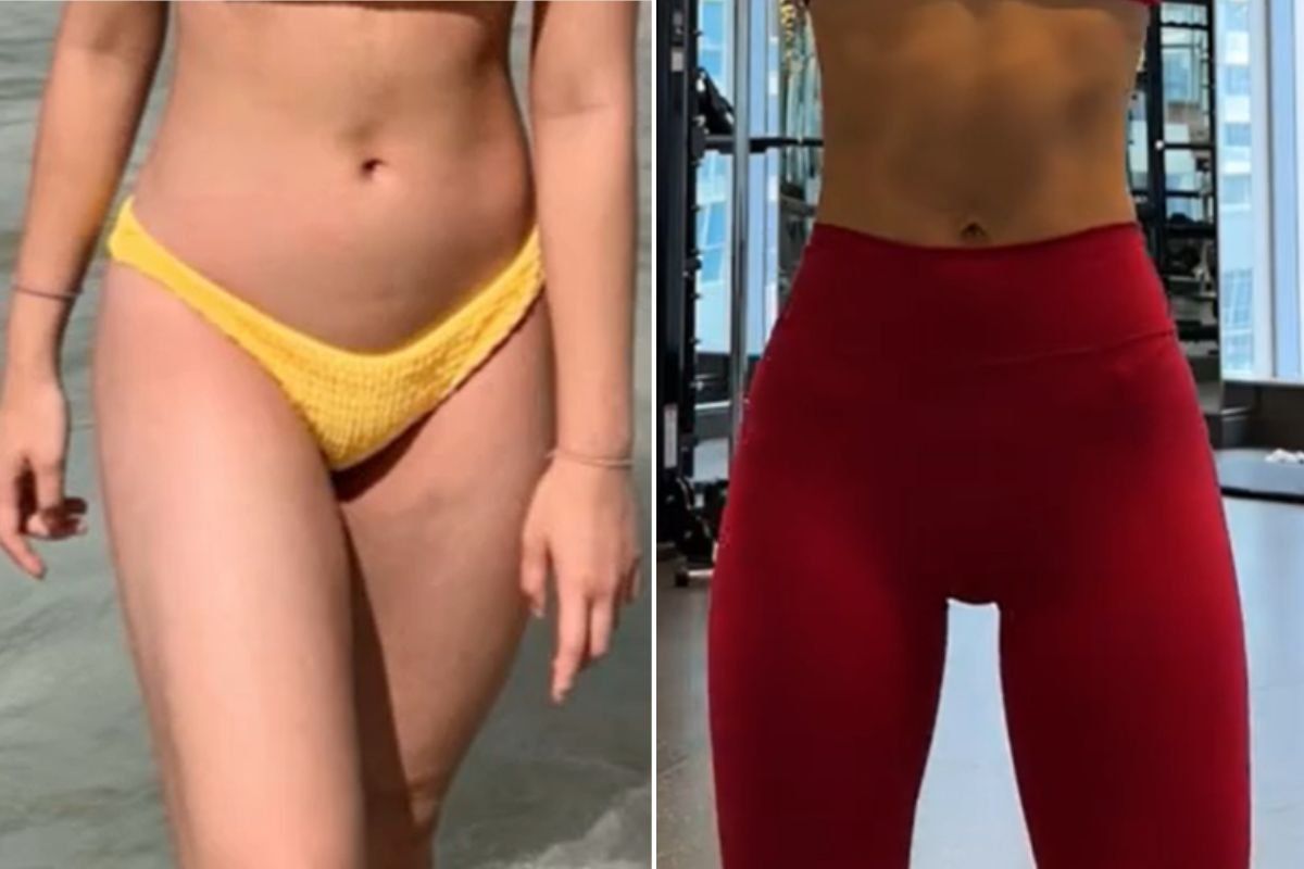 KAILA BEFORE AND AFTER