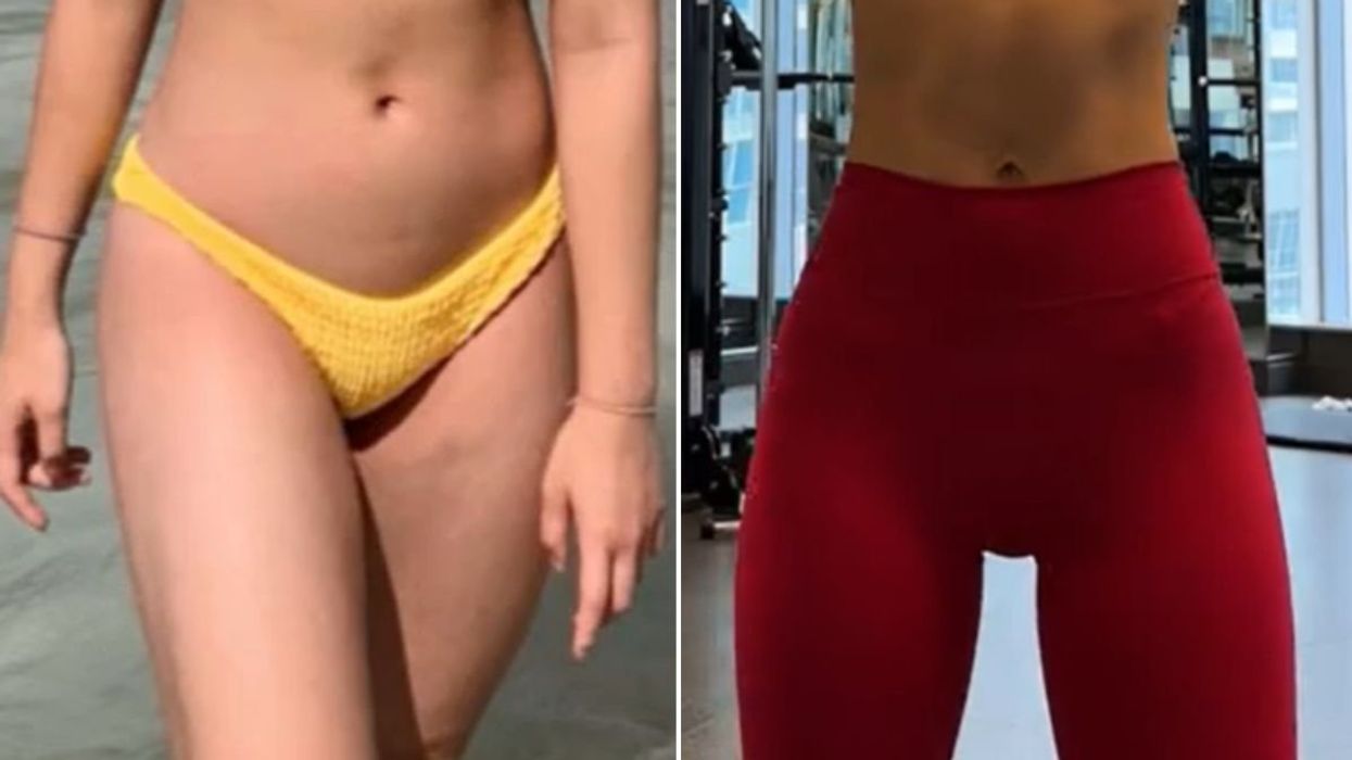 KAILA BEFORE AND AFTER