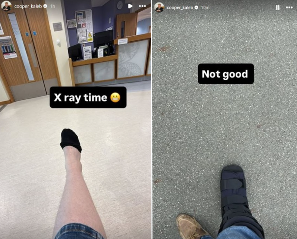 Kaleb Cooper ankle injury