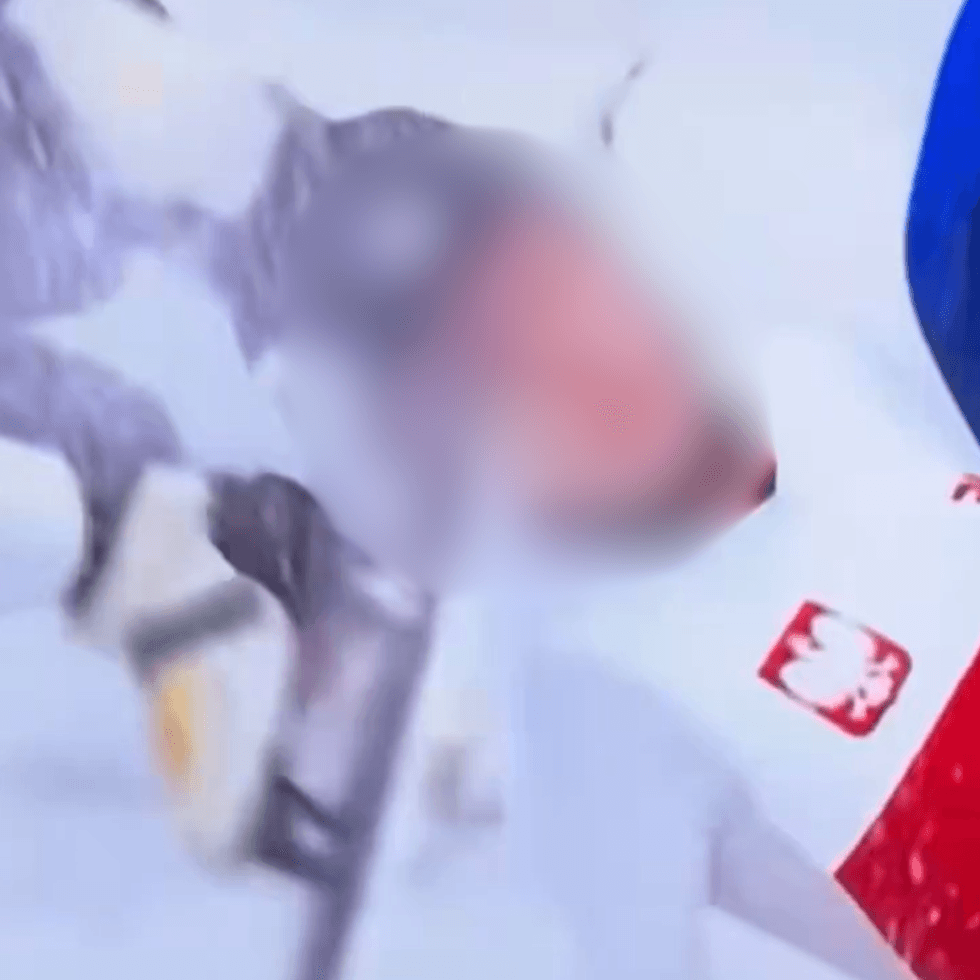 Kamila Sellier injury