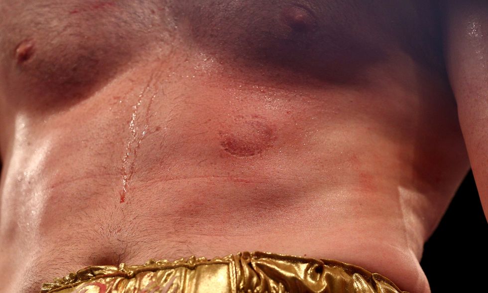 Kash Ali was banned for biting David Price