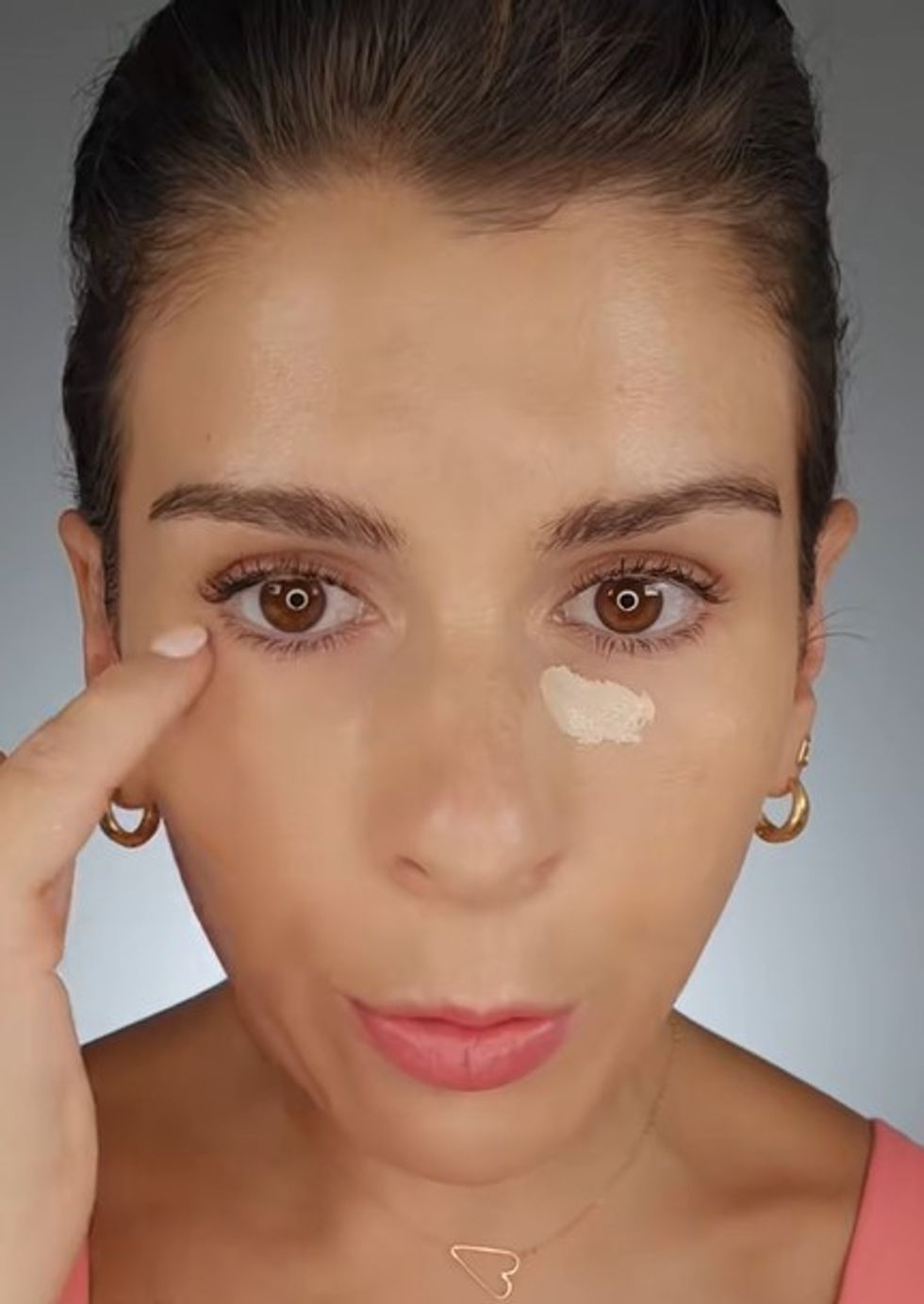 Kate demonstrating where not to apply concealer