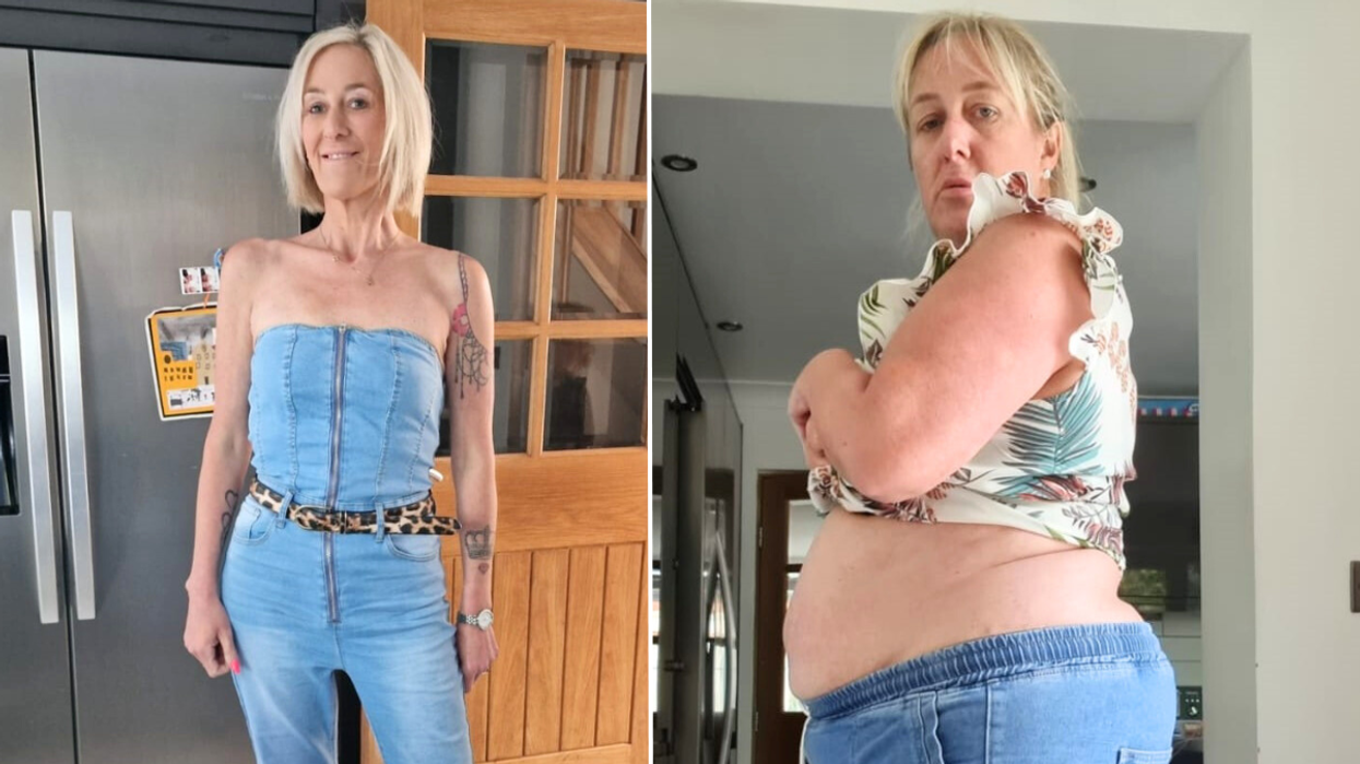 Kelly before / after weight loss
