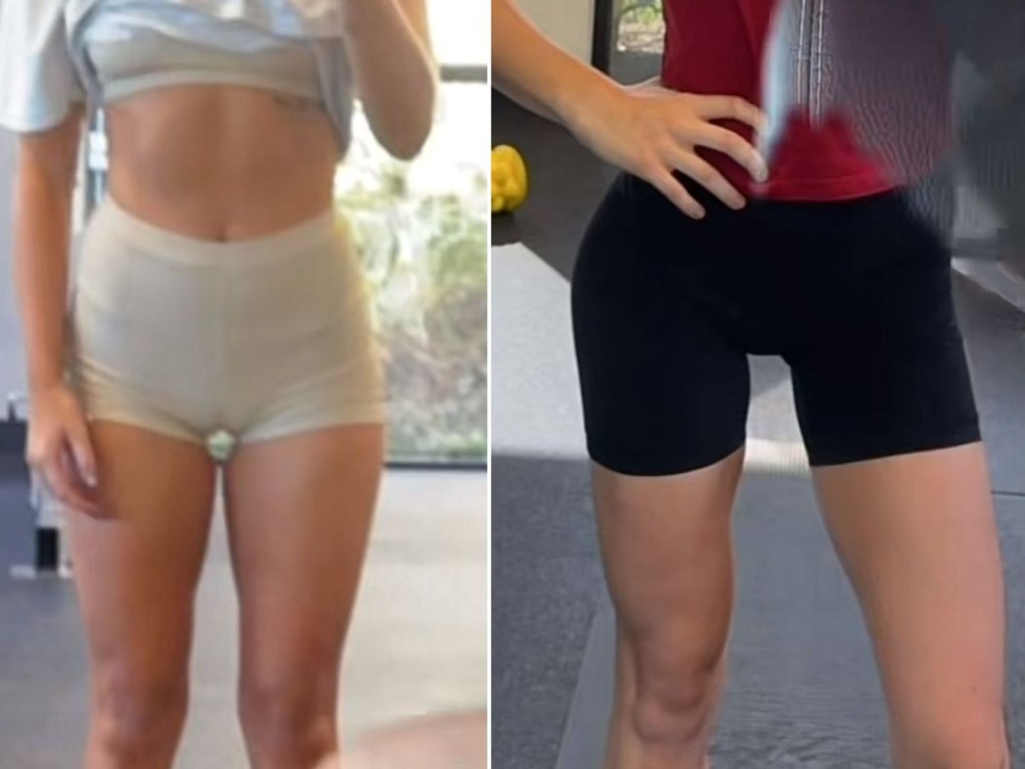 Kelsey's legs before and after