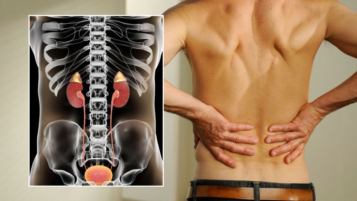 kidney illustration and man with back pain