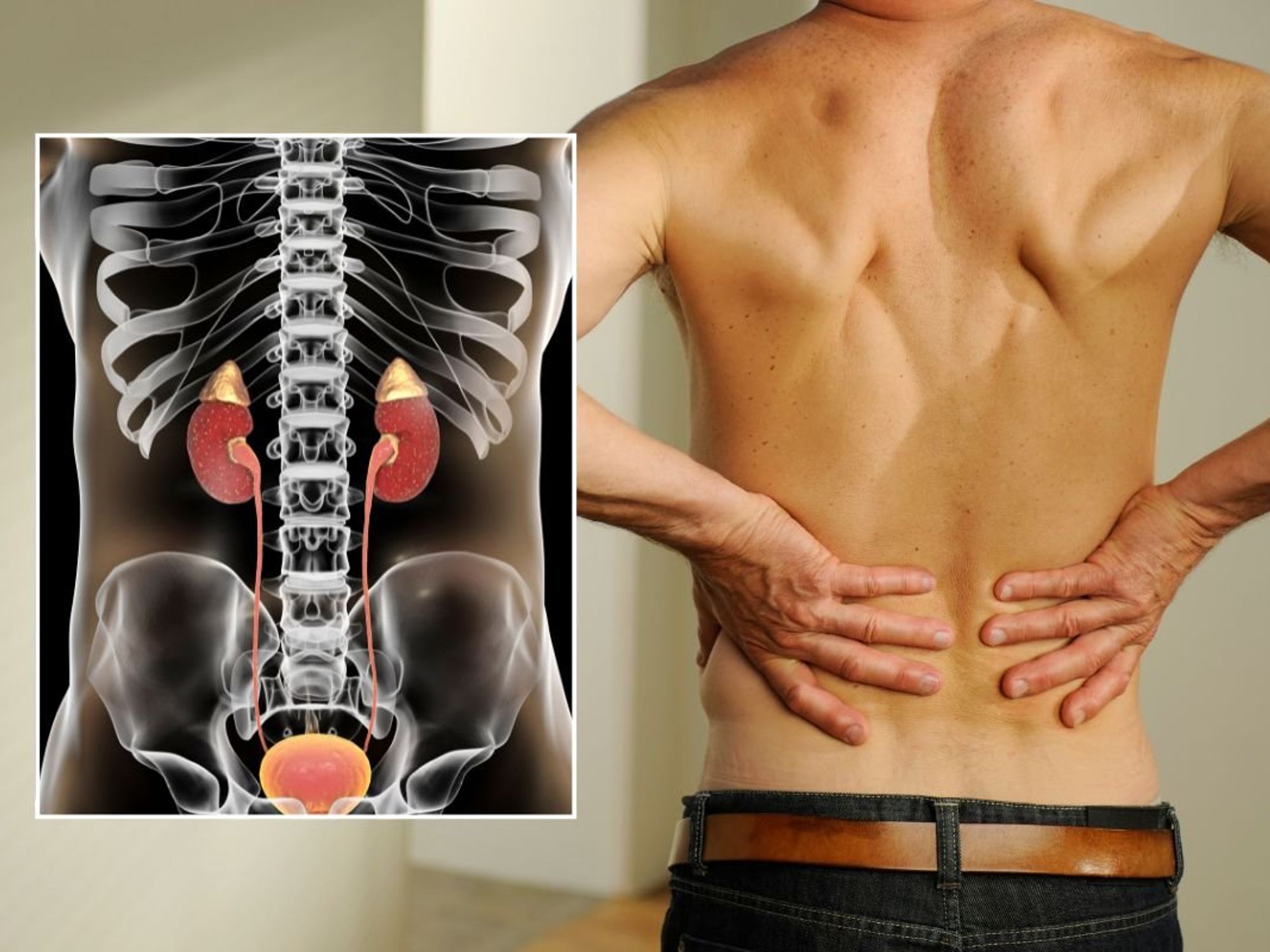 kidney illustration and man with back pain
